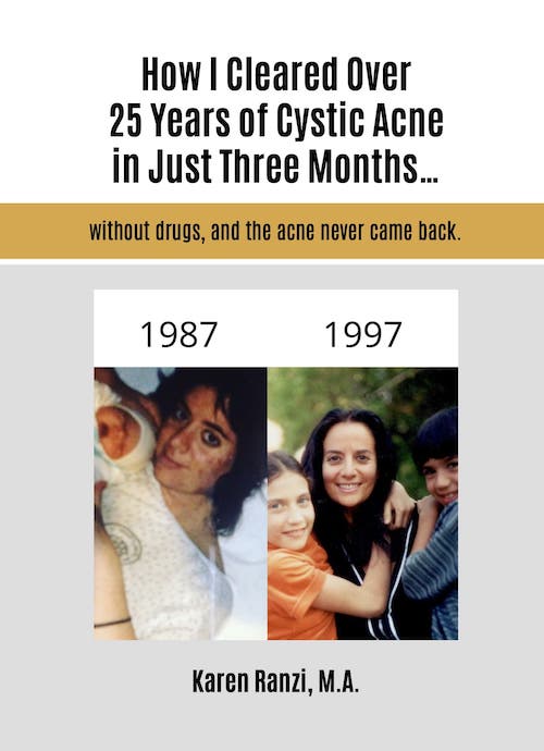 Karen Ranzi • How I Cleared Over 25 Years of Cystic Acne Cover