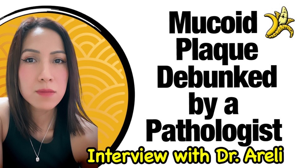Mucoid Plaque Debunked by Dr Douglas Graham | 47-Year Raw Vegan Tells All 2 mucoid plaque debunked with dr. areli