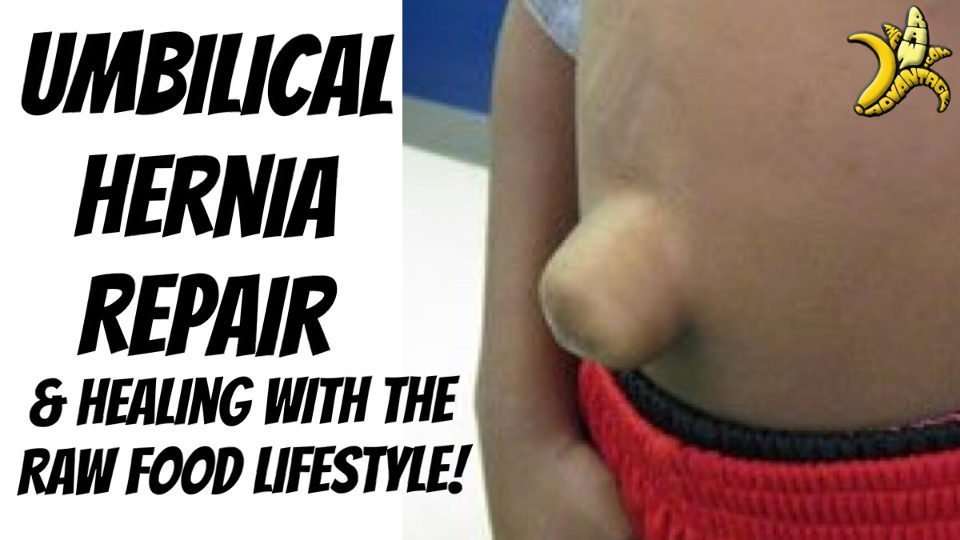 Umbilical Hernia Repair and Healing with a Raw food Lifestyle