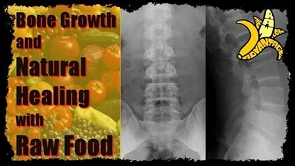 bone growth natural healing with raw food