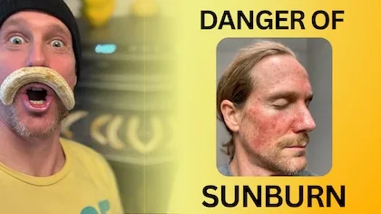 Skin Cancer Prevention